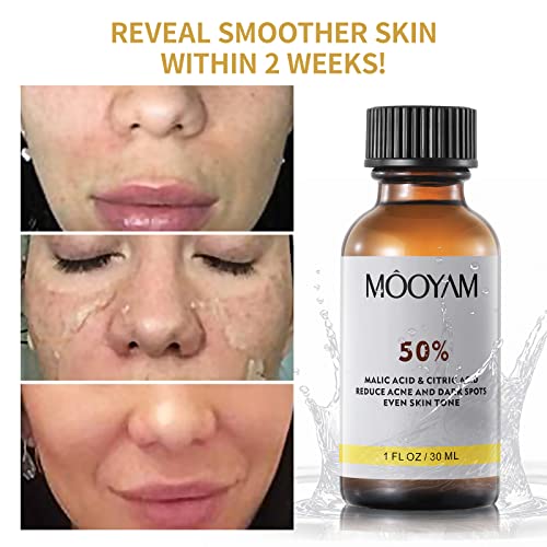 ?25% TCA Skin Peel Kit? - Image 2