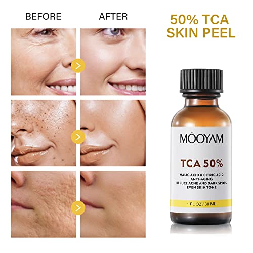 ?25% TCA Skin Peel Kit? - Image 4