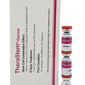 50% Off Anti Wrinkle Injections