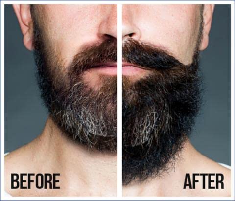 Black Castor Oil for Stronger Beard - Image 2