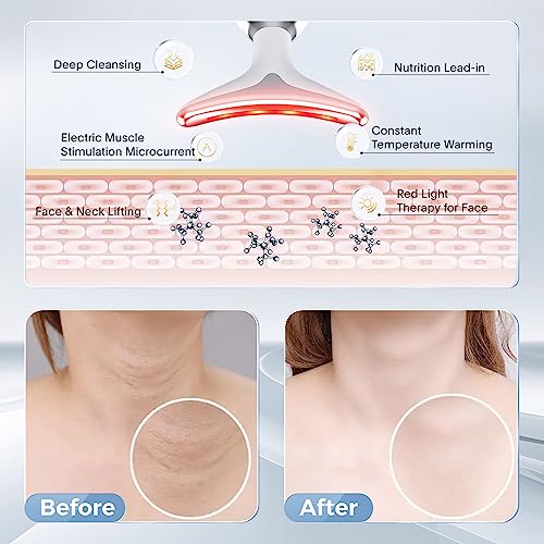 5-in-1 LED Anti-Aging Device - Image 5