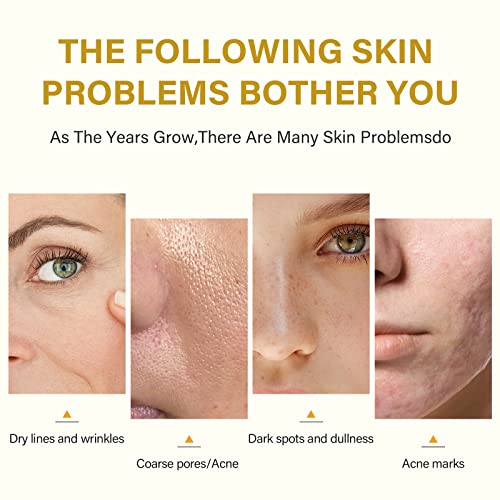 ?25% TCA Skin Peel Kit? - Image 3
