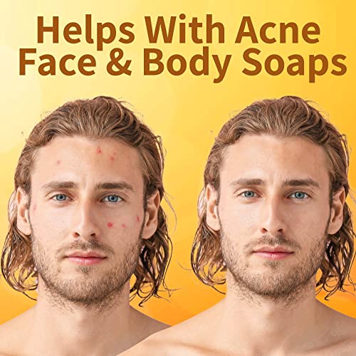 Gentle Acne Body Wash for Prone Skin - 8 oz Bottle - Image 4
