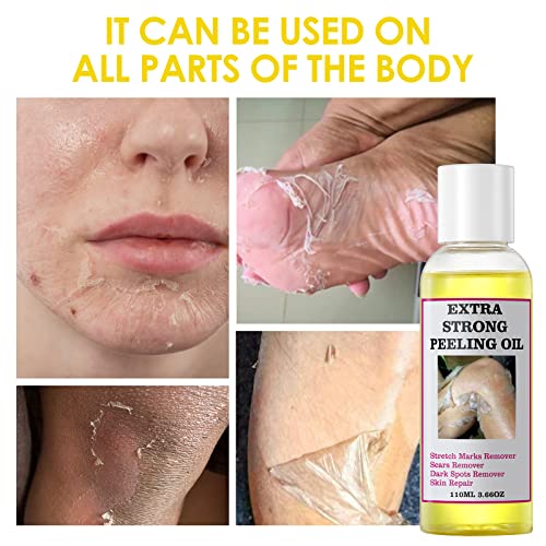 Triple layer skin peel for smoother, rejuvenated skin. - Image 2