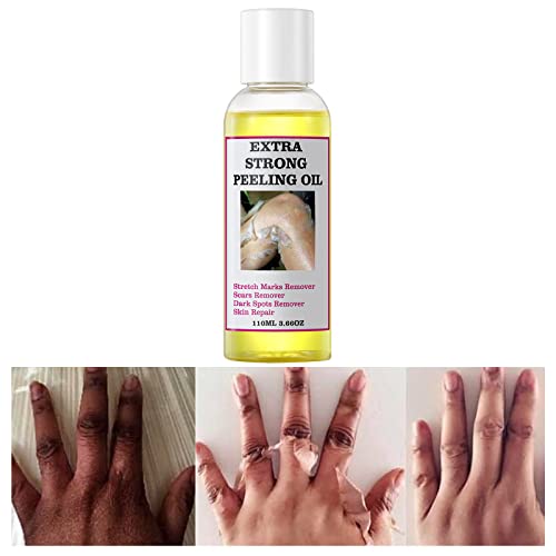 Triple layer skin peel for smoother, rejuvenated skin.