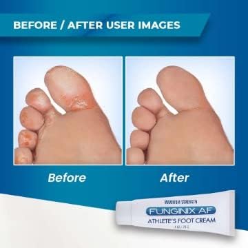 Funginix AF Foot Cream 1.7 oz for Effective Athlete's Foot Treatment - Image 3