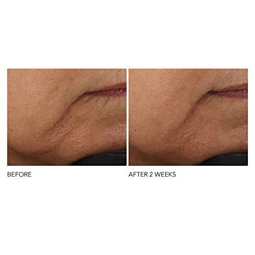 Clinique Anti-Aging Cream for Women 1.7 oz Combat Visible Signs of Aging - Image 6