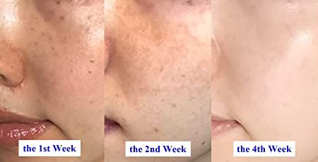 Anti Aging Treatment Serum 1 oz Bottle - Image 7