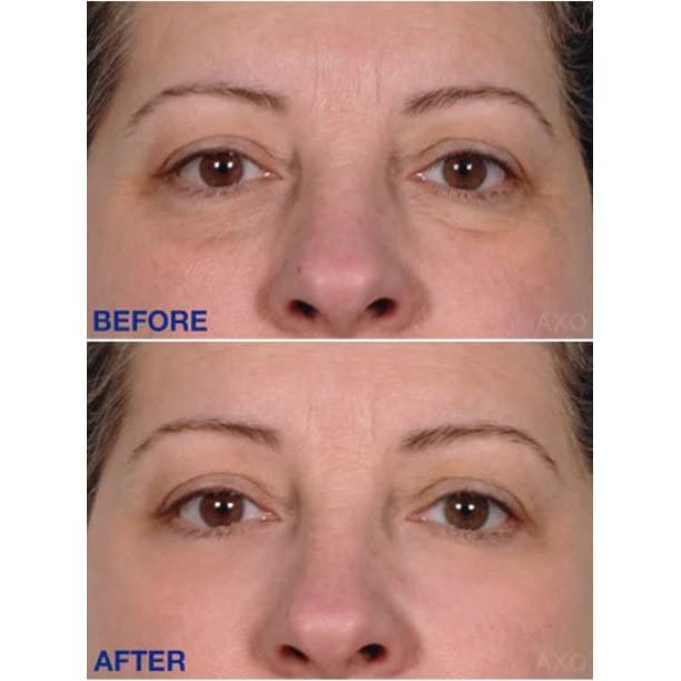 ?Skincare for Preventing Aging in Your 20s? - Image 5