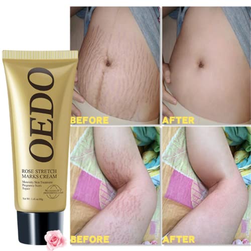 Pregnancy & Anti-Aging Cream 50ml for Expecting Mothers with Essential Information - Image 2