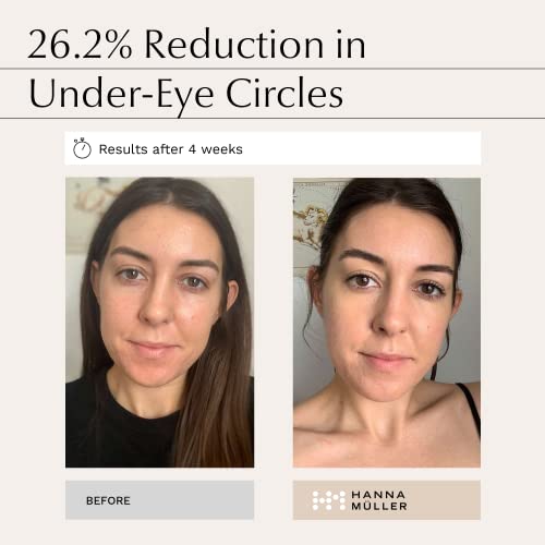 Clinique Even Better Clinical Radical Dark Spot Corrector 1 oz - Image 2