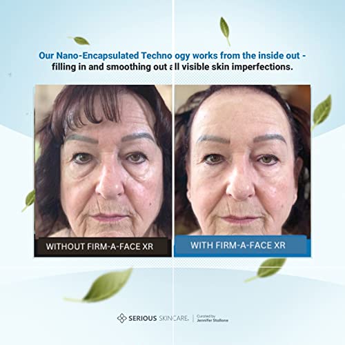 ?Nearby Anti Aging Treatment? - Image 4