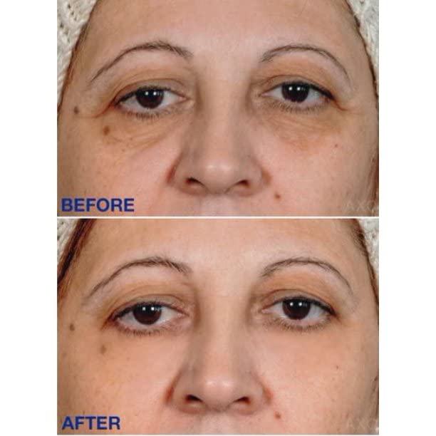 ?Skincare for Preventing Aging in Your 20s? - Image 6
