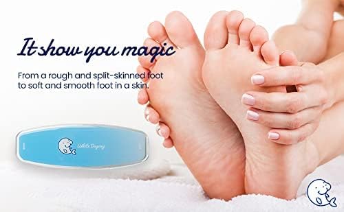 Gentle scrub for baby?s feet. - Image 4