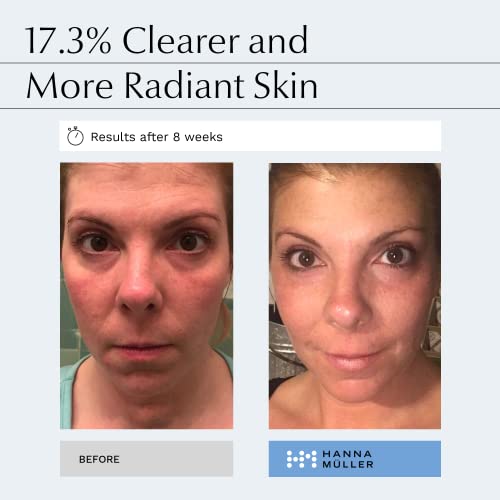 Age-Defying Hand Cream for Youthful, Smoother Skin 2oz - Image 2