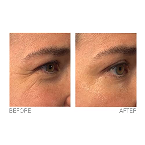 Instant Anti-Wrinkle Concentrate for Agefit 1.7 fl oz New - Image 7