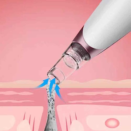 Clinique Face Brush: Deeply Cleanses Skin - Image 4