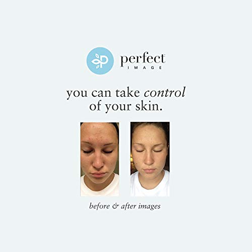 Gentle, natural glycolic peel for skin rejuvenation. - Image 6