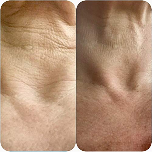 Neck pads for reducing wrinkles. - Image 8