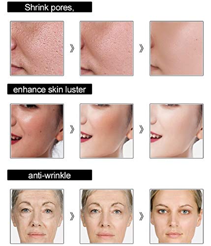 Hyaluronic Acid Anti-Aging Serum for Skin Care 1 oz Hydrating Formula - Image 5