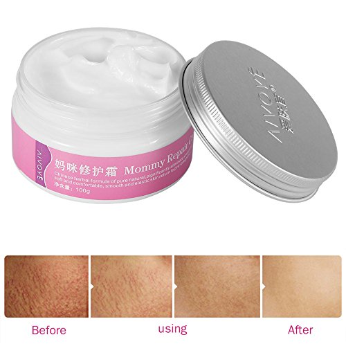 Pregnancy Moisturizing Body Cream 8 oz Hydrating Formula for Expecting Mothers - Image 5