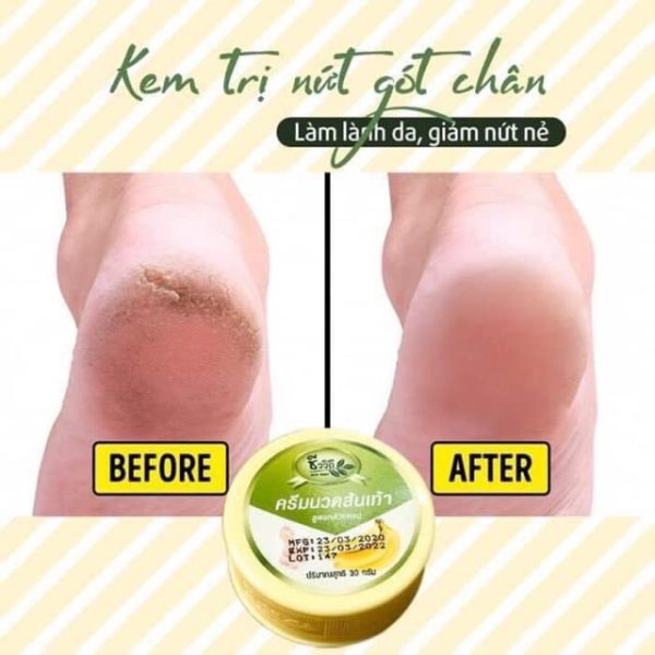 "30 Natural Foot Cream" - Image 3