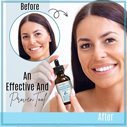 Glycolic Peel for Full Body Renewal - Image 6