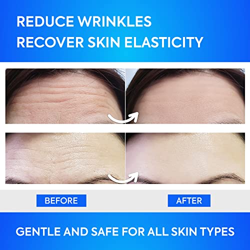?Anti Wrinkle Patch by Biobliss? - Image 5