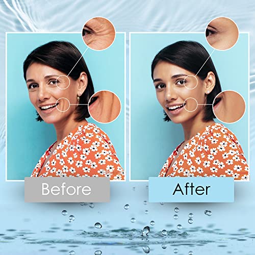 ?Prx T33 Peel: Medical-grade Skin Treatment? - Image 7