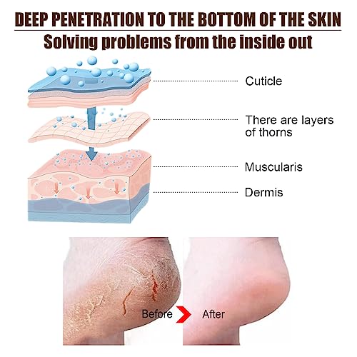 All-Natural Foot Cream for Natural Beauty and Soft Skin 100ml - Image 3