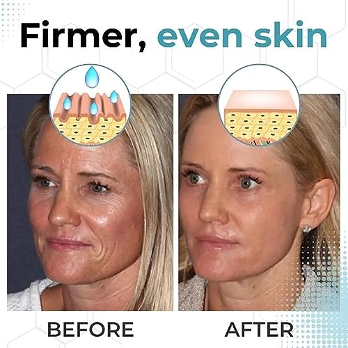 Aldi?s Wrinkle-Fighting Serum - Image 6