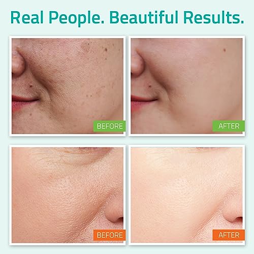 ?Age-defying Skincare System? - Image 4