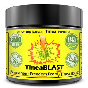 Dandruff Shampoo treats Tinea Versicolor