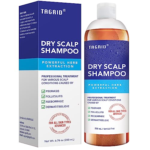 Kp Namboodiris Dandruff Shampoo 200ml Gentle Hair Care Scalp Relief Formula
