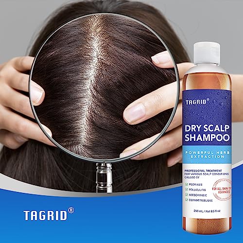 Kp Namboodiris Dandruff Shampoo 200ml Gentle Hair Care Scalp Relief Formula - Image 6