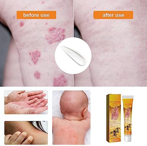 Bee Venom Cream for the Body - Image 6