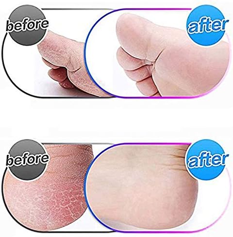 Amope Pedi Perfect Pedicure Kit - Image 6