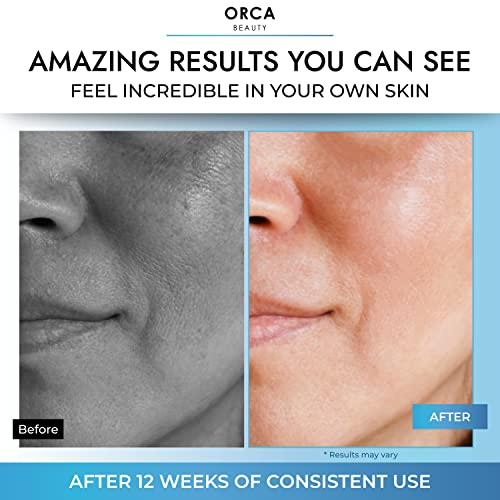 L'Oréal Revitalift 2-Piece Glycolic Acid Mini Peel Anti-Aging Treatment Kit - Image 4