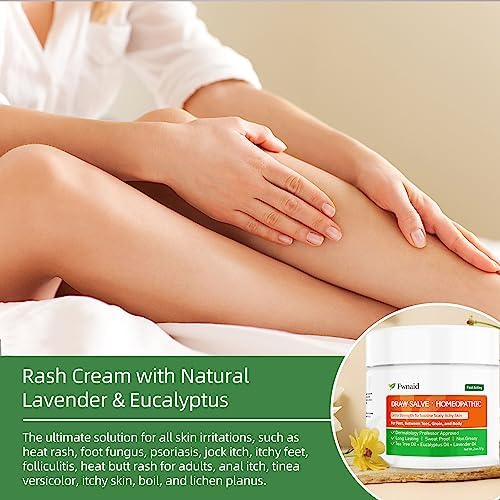 Natural Antifungal Foot Cream for Itch Relief and Healthy Feet - Image 2