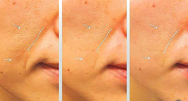 Anti Aging Treatment Serum 1 oz Bottle - Image 5