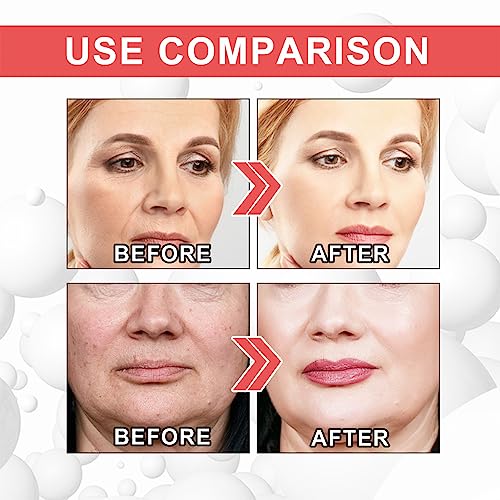 ?Anti-Aging Cream for Wrinkles and Fine Lines? - Image 5