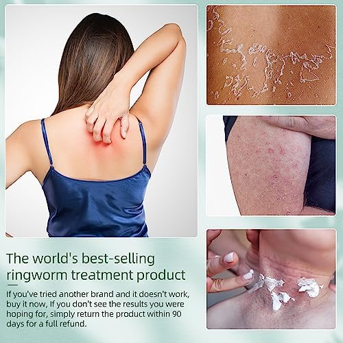 Natural Antifungal Foot Cream for Itch Relief and Healthy Feet - Image 6