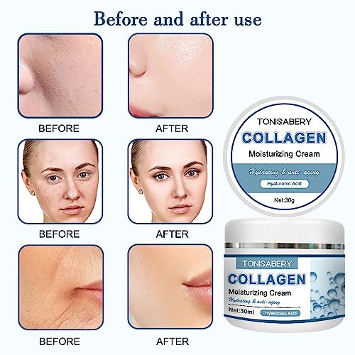 ?Anti Aging Cream for Wrinkles? - Image 8