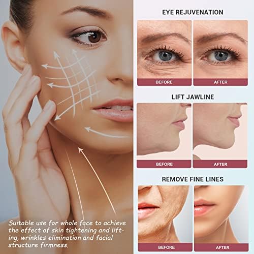 Rejuvenate Your Skin: Advanced Anti-Aging Facial Machine with LED Light Therapy for Youthful Home Use - Image 2