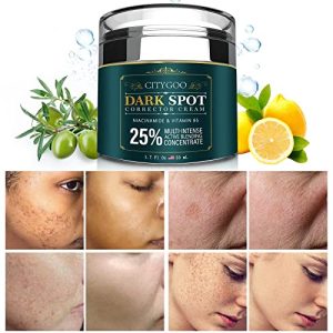 Body Spot Remover Cream for Effective Spot Removal
