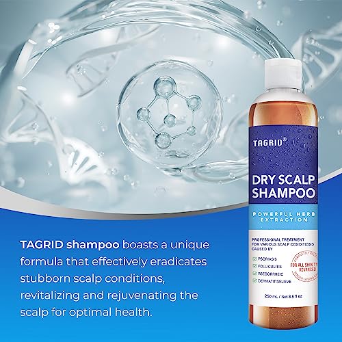 Kp Namboodiris Dandruff Shampoo 200ml Gentle Hair Care Scalp Relief Formula - Image 4