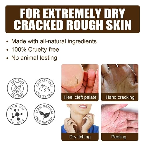 All-Natural Foot Cream for Natural Beauty and Soft Skin 100ml - Image 2