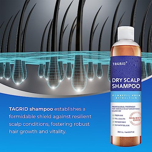 Kp Namboodiris Dandruff Shampoo 200ml Gentle Hair Care Scalp Relief Formula - Image 5