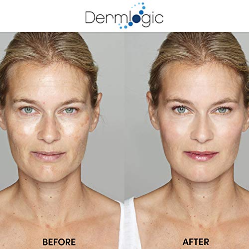 ?Akina Skin Peel: Magic Treatment? - Image 3