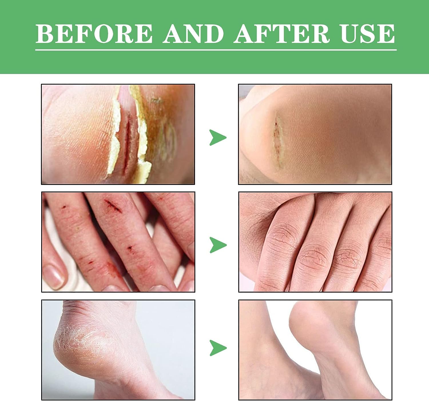 Cream with avocado for soft, moisturized feet. - Image 2